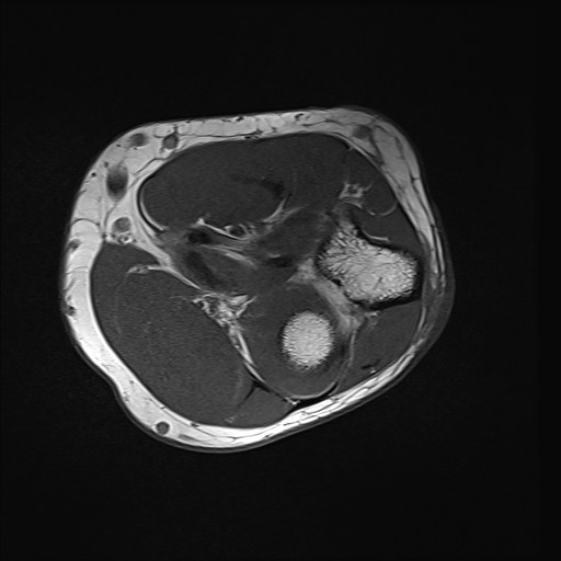 Click on the Serie image to view the images of Wieszt, Gnter